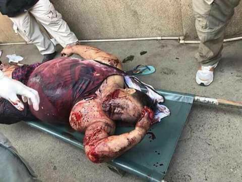 pnp parojinog dead 1